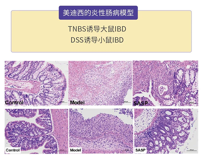 凯时首页的炎性肠病模型.png