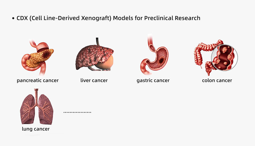 人源肿瘤细胞系异种移植（CDX）模型在临床前研究中的应用